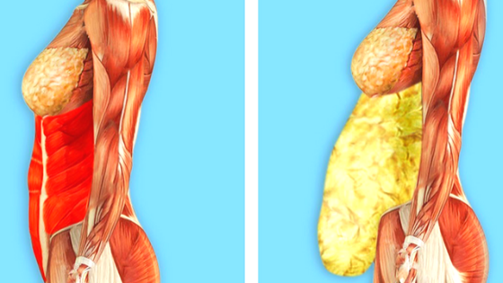 obesity toxins foods